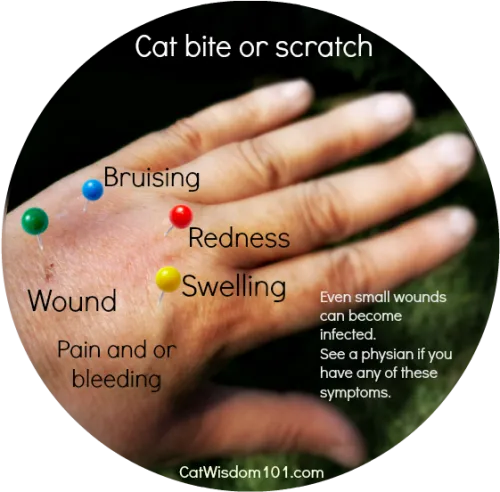 Cat Bite-scratch Pasteurella - Cat Bite Vs Scratch